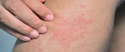 اخبار اليمن الان الحدث اليوم عاجل سبق