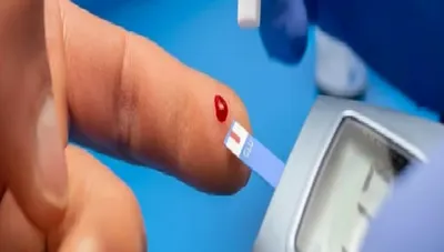 الجيل اخبار اليمن الان بالفيديو استشاري العلاج للنوعين والثاني اخبار اليمن الان الحدث اليوم عاجل الجيل