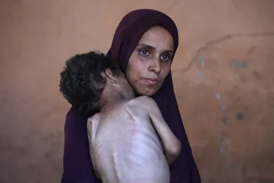اخبار اليمن الان الحدث اليوم عاجل cnn عربي