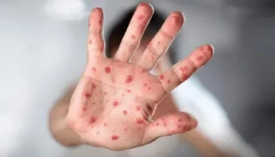 اخبار اليمن الان الحدث اليوم عاجل سبق