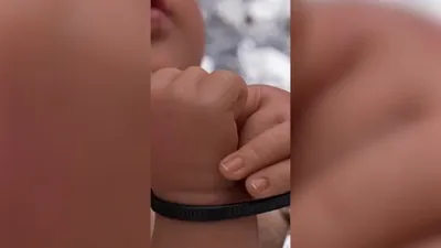 اخبار اليمن الان الحدث اليوم عاجل cnn عربي