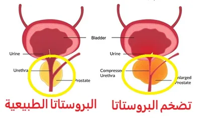 اخبار اليمن الان الحدث اليوم عاجل سبق