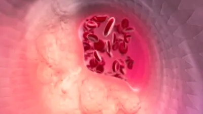 cnn عربي اخبار اليمن الان دراسة تجريبية واعدة الكوليسترول الضار اخبار اليمن الان الحدث اليوم عاجل cnn عربي