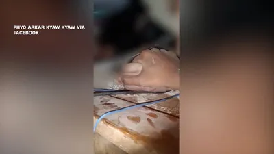 اخبار اليمن الان الحدث اليوم عاجل cnn عربي