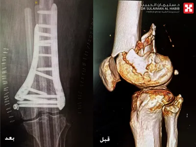 اخبار اليمن الان الحدث اليوم عاجل سبق