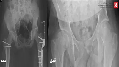 سبق اخبار اليمن الان مستشفى الدكتور سليمان الحبيب بالخبر اخبار اليمن الان الحدث اليوم عاجل سبق