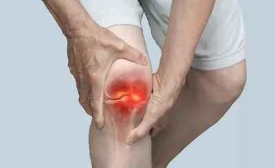 سبق اخبار اليمن الان فيروس شيكونغونيا الإصابة المفاصل المزمنة اخبار اليمن الان الحدث اليوم عاجل سبق
