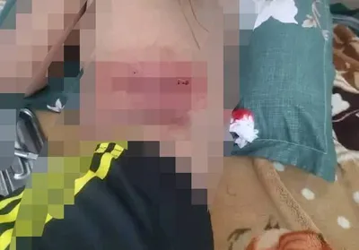 اخبار اليمن الان الحدث اليوم عاجل العاصفه نيوز