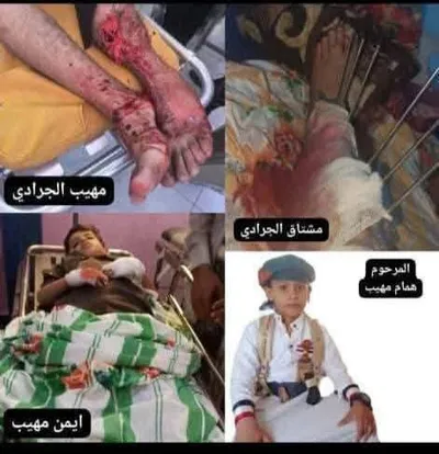 اخبار اليمن الان الحدث اليوم عاجل المشهد اليمني