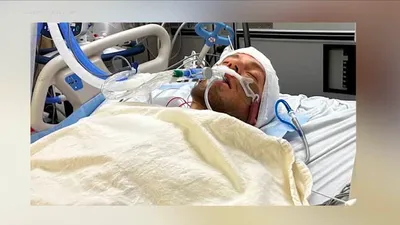 اخبار اليمن الان الحدث اليوم عاجل cnn عربي
