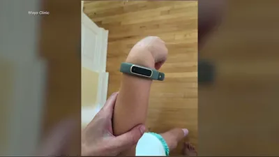 اخبار اليمن الان الحدث اليوم عاجل cnn عربي