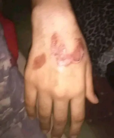 المشهد اليمني اخبار اليمن الان زوجته ويحلق شعرها ويحرق بطريقة اخبار اليمن الان الحدث اليوم عاجل المشهد اليمني