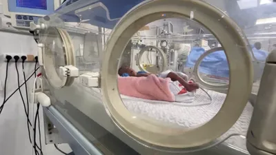 cnn عربي اخبار اليمن الان الرضيعة المصري التغذية الأزمة الإنسانية اخبار اليمن الان الحدث اليوم عاجل cnn عربي