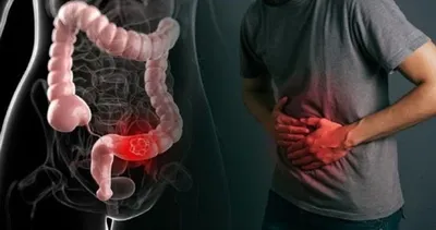 سبق اخبار اليمن الان الخضيري الإمساك العصر والسمنة الوقاية اخبار اليمن الان الحدث اليوم عاجل سبق