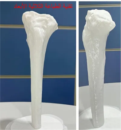 سبق اخبار اليمن الان انحراف الركبة الطباعة الأبعاد الجامعي اخبار اليمن الان الحدث اليوم عاجل سبق
