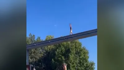 cnn عربي اخبار اليمن الان لحظات مرعبة لطفل هيرشي الأحادي  اخبار اليمن الان الحدث اليوم عاجل cnn عربي