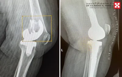 اخبار اليمن الان الحدث اليوم عاجل سبق