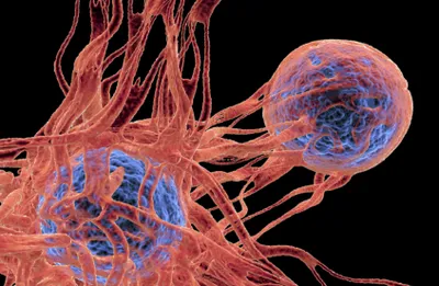 سبق اخبار اليمن الان lipydau الأمل كيميائي الأورام المستعصية اخبار اليمن الان الحدث اليوم عاجل سبق