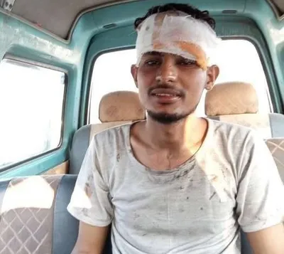 العاصفه نيوز اخبار اليمن الان مواطن ينقذ محرقة النقل الجماعي اخبار اليمن الان الحدث اليوم عاجل العاصفه نيوز