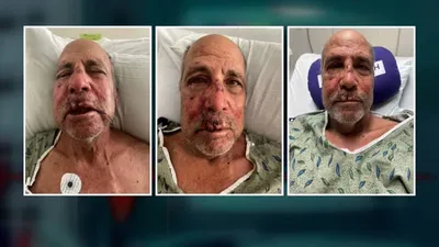 اخبار اليمن الان الحدث اليوم عاجل cnn عربي