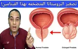 مارب برس اخبار اليمن الان للرجال وفعال إليك الفيتامينات للبروستاتا اخبار اليمن الان الحدث اليوم عاجل مارب برس