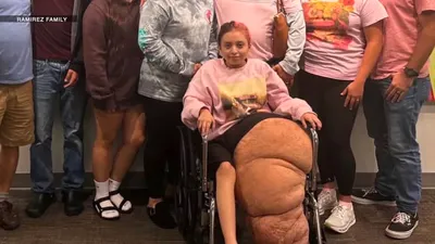 اخبار اليمن الان الحدث اليوم عاجل cnn عربي