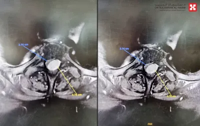 سبق اخبار اليمن الان الدكتور سليمان الحبيب بالعليا الحركة اخبار اليمن الان الحدث اليوم عاجل سبق