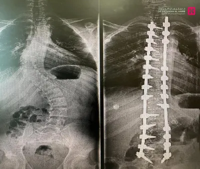 اخبار اليمن الان الحدث اليوم عاجل سبق
