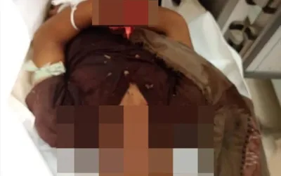 اخبار اليمن الان الحدث اليوم عاجل العاصفه نيوز