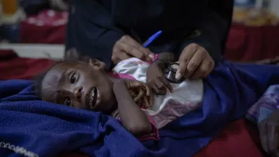 cnn عربي اخبار اليمن الان الواقع المروع للحرب الأهلية السودان اخبار اليمن الان الحدث اليوم عاجل cnn عربي