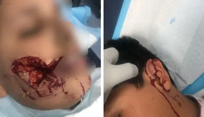 اخبار اليمن الان الحدث اليوم عاجل سبق