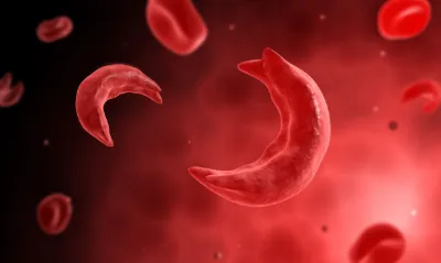 اخبار اليمن الان الحدث اليوم عاجل سبق