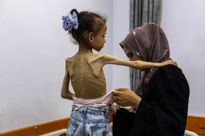اخبار اليمن الان الحدث اليوم عاجل سبق