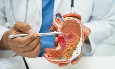 شمسان بوست اخبار اليمن الان أسباب قرحة المعدة وكيف علاجها اخبار اليمن الان الحدث اليوم عاجل شمسان بوست