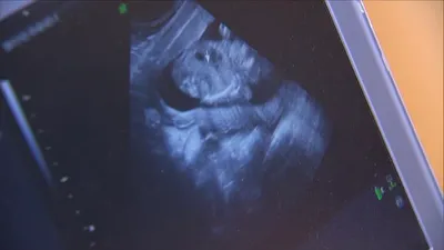 اخبار اليمن الان الحدث اليوم عاجل cnn عربي