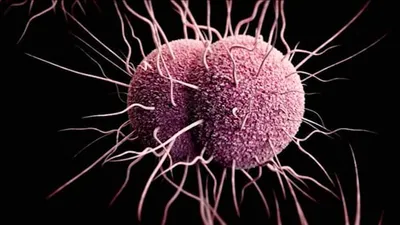 اخبار اليمن الان الحدث اليوم عاجل cnn عربي